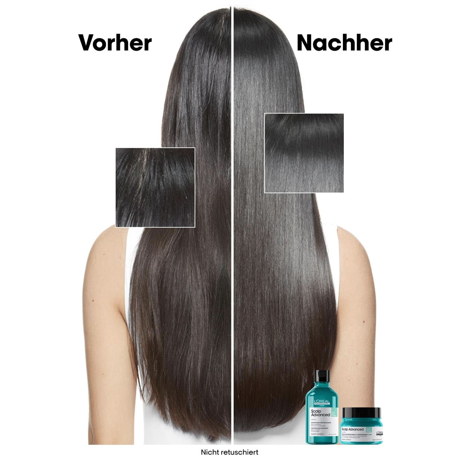L'Oréal Professionnel Reinigungsshampoo für fettige Kopfhaut, 300 ml, Naty Shop Dusche und Bad