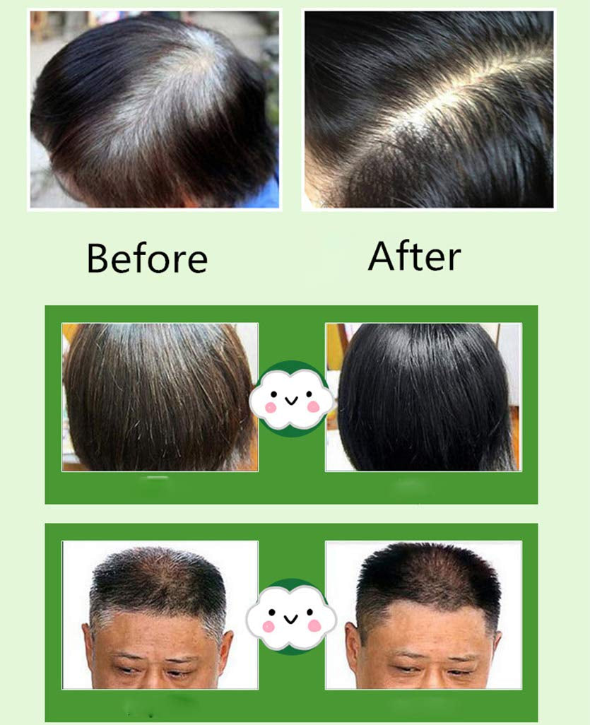 Natürliche Inhaltsstoffe, sofortiges schwarzes Haarfärbe-Shampoo, halbpermanente schwarze Haarfarbe, einfach anzuwenden, langlebig, natürliche Inhaltsstoffe (10 Stück, schwarz) Naty Shop Haarfärbemittel