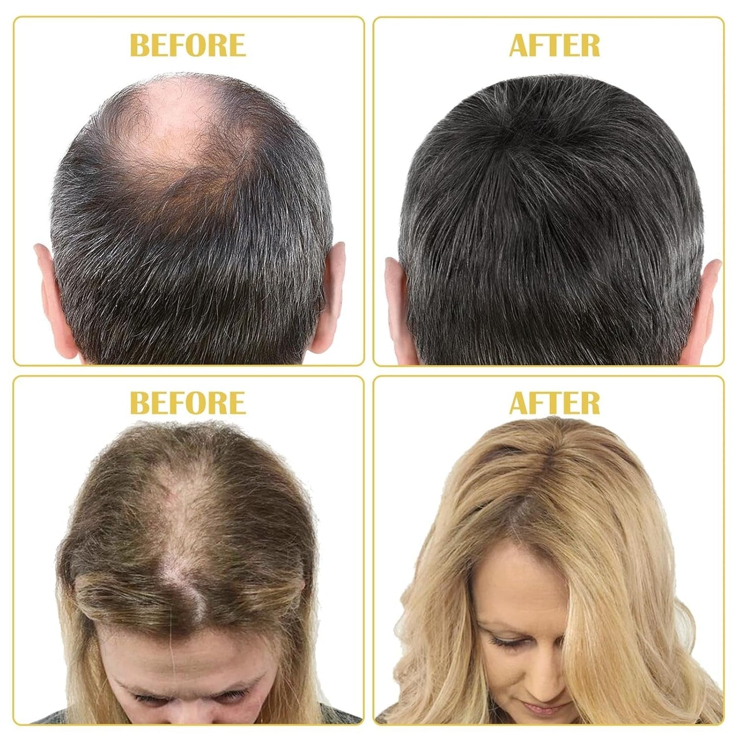 Bio-Haarwachstumsöl 5 % – Lösung zur äußerlichen Anwendung – Haarwachstum und -verdichtung – Für männlichen Haarausfall und dünner werdendes Haar – Reaktiviert schrumpfende Follikel – Präziser Pumpspender, 60 ml Haarpflege Naty Shop