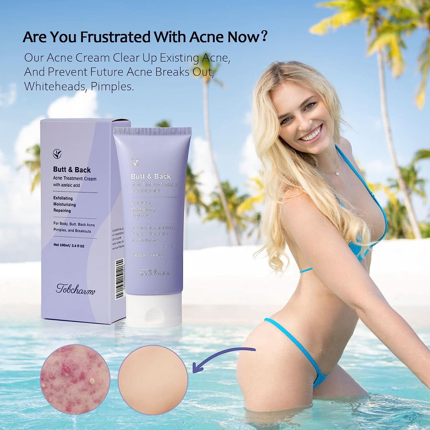 Anti-Akne-Creme, 100 ml Kosmetik und Schönheit Naty Shop