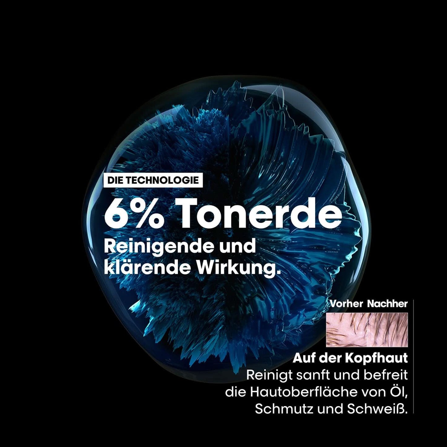 L'Oréal Professionnel Reinigungsshampoo für fettige Kopfhaut, 300 ml, Naty Shop Dusche und Bad