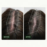 Haarwuchsroutine von Scandinavian Biolabs für Frauen mit klinisch nachgewiesenen Ergebnissen in 45 Tagen | Behandlung gegen Haarausfall (Bio-Pilixin) Naty Shop Haarpflege