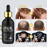 Bio-Haarwachstumsöl 5 % – Lösung zur äußerlichen Anwendung – Haarwachstum und -verdichtung – Für männlichen Haarausfall und dünner werdendes Haar – Reaktiviert schrumpfende Follikel – Präziser Pumpspender, 60 ml Haarpflege Naty Shop